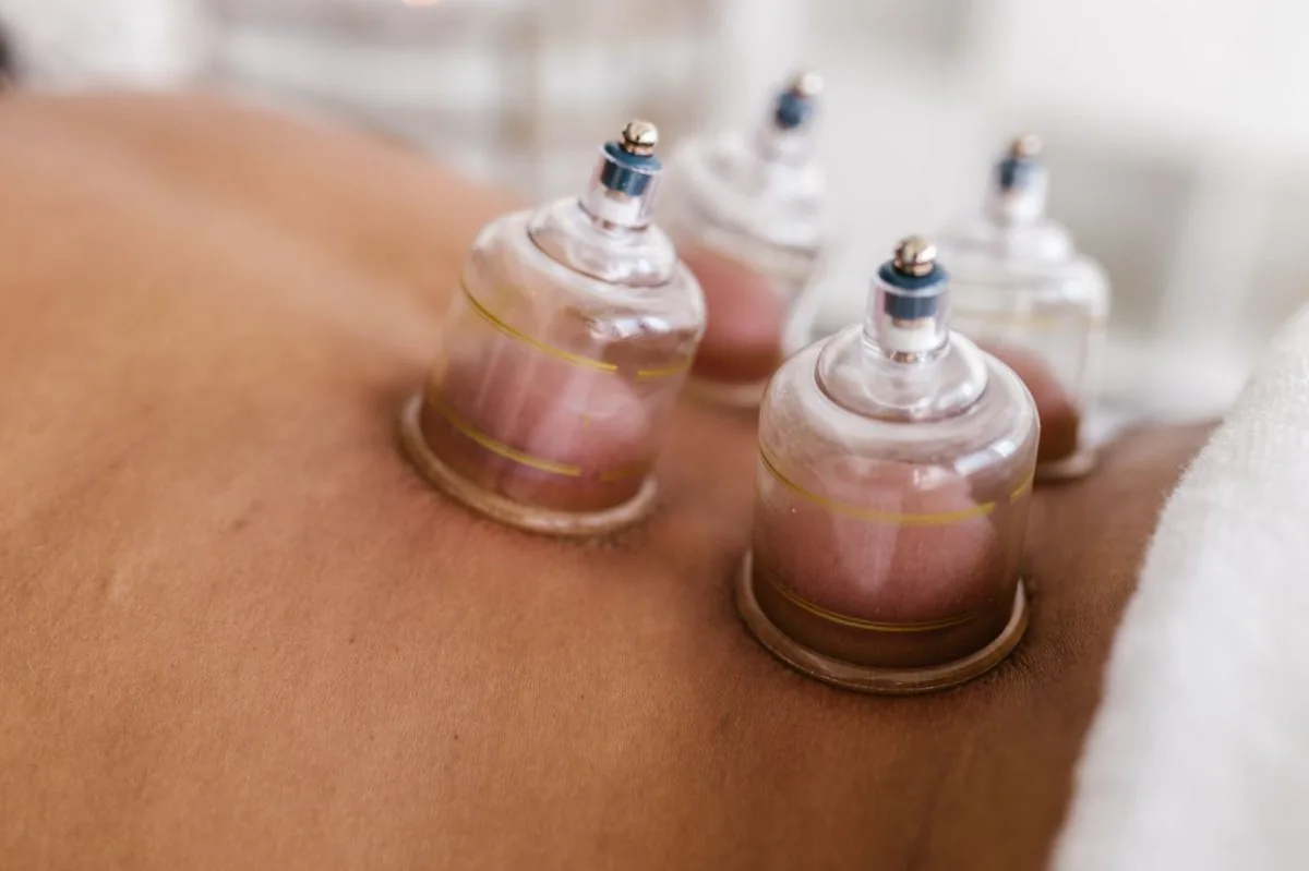 Clear suction cups used during a back cupping session; illustrative photograph