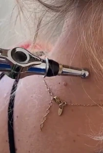 A handheld device near the neck; illustrative supplied image